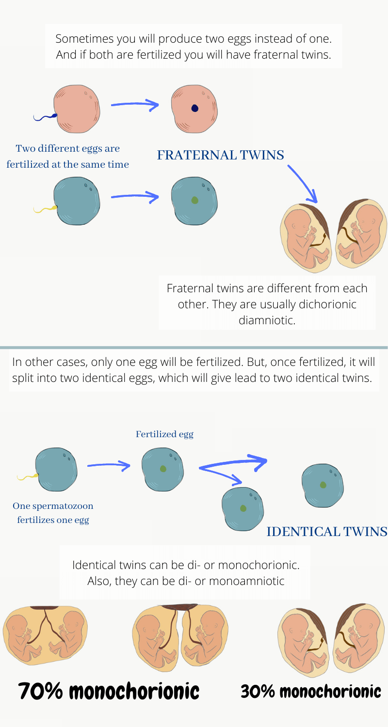 Infographic explaining the multiple pregnancies