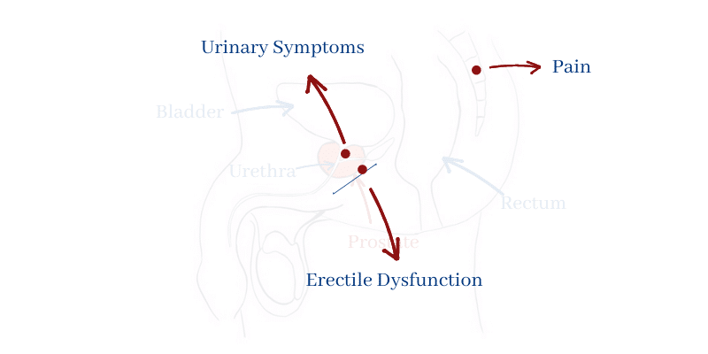 Prostate cancer symptoms 