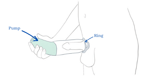 Penis pump components