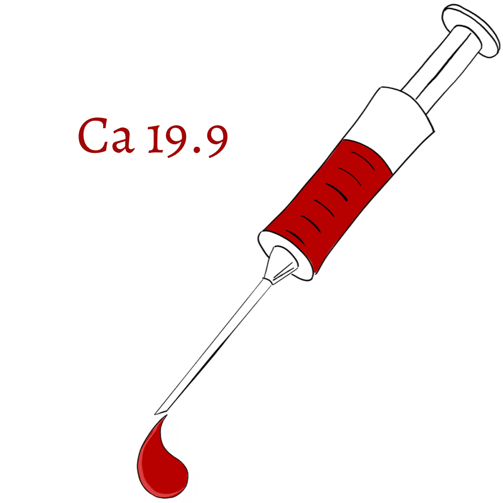 Ca 19.9: tumoral marker for pancreatic cancer