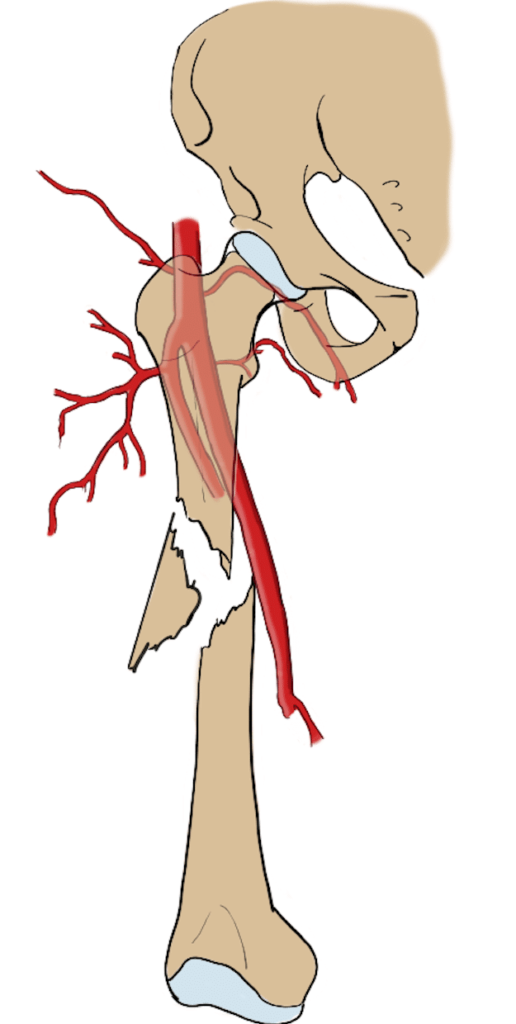 Femoral arteries near the femur