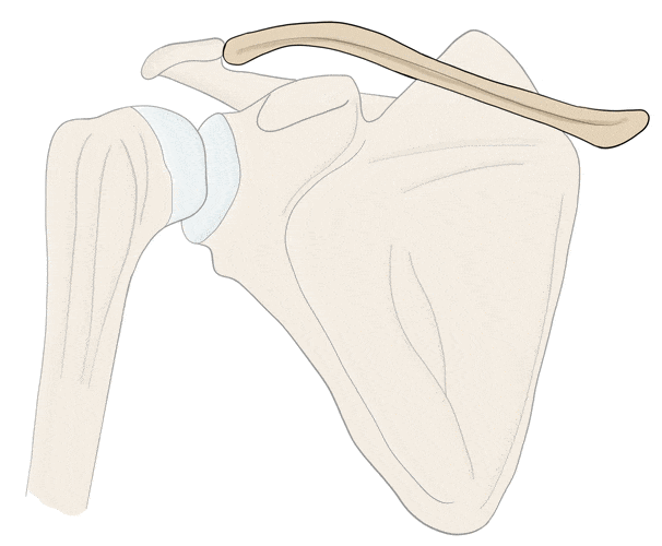 GIF : shoulder fractures showing affecting the clavicle, which is forming a callus with conservative treatment