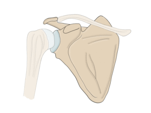 GIF - glenoid fracture treated with plate and screws