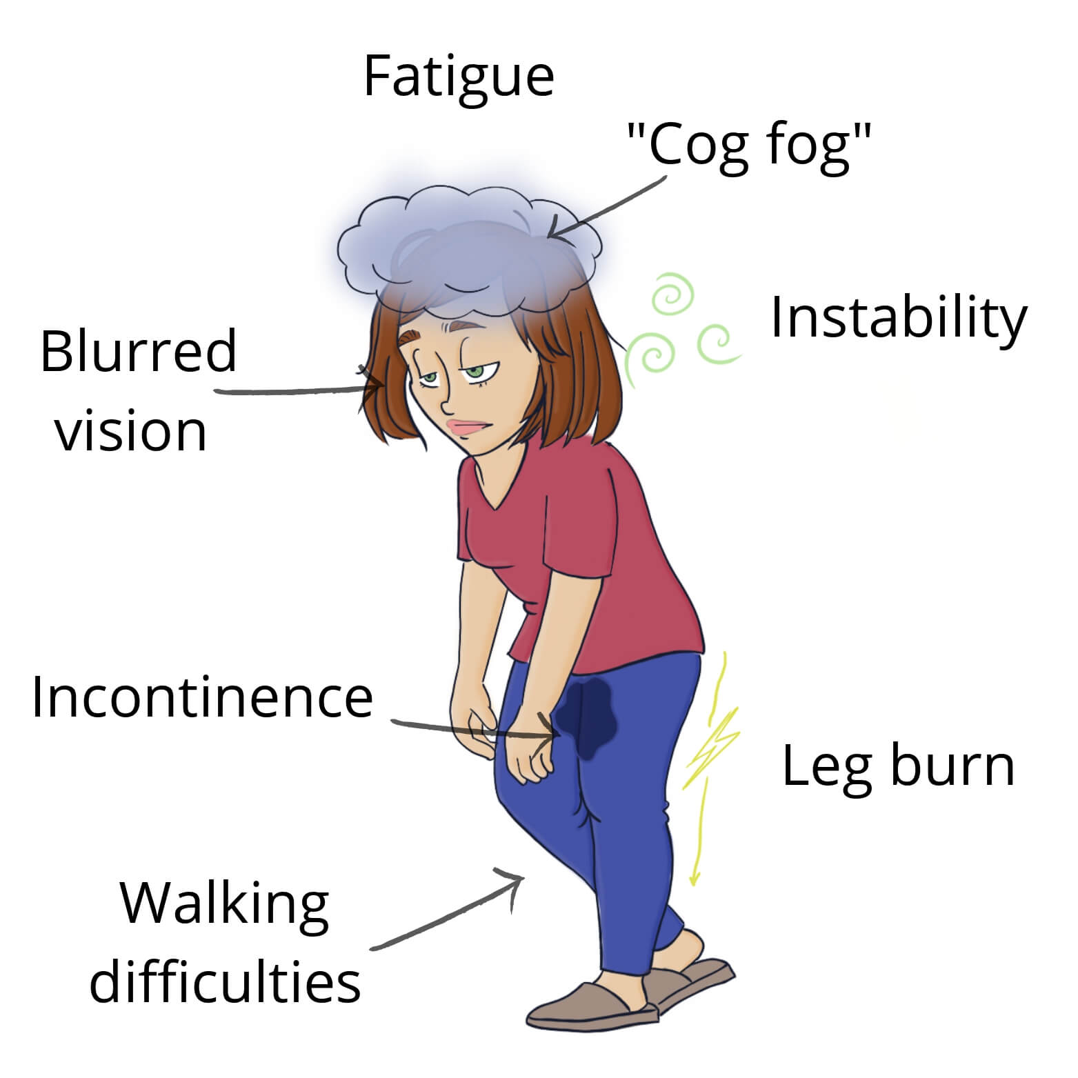 Multiple Sclerosis Symptoms