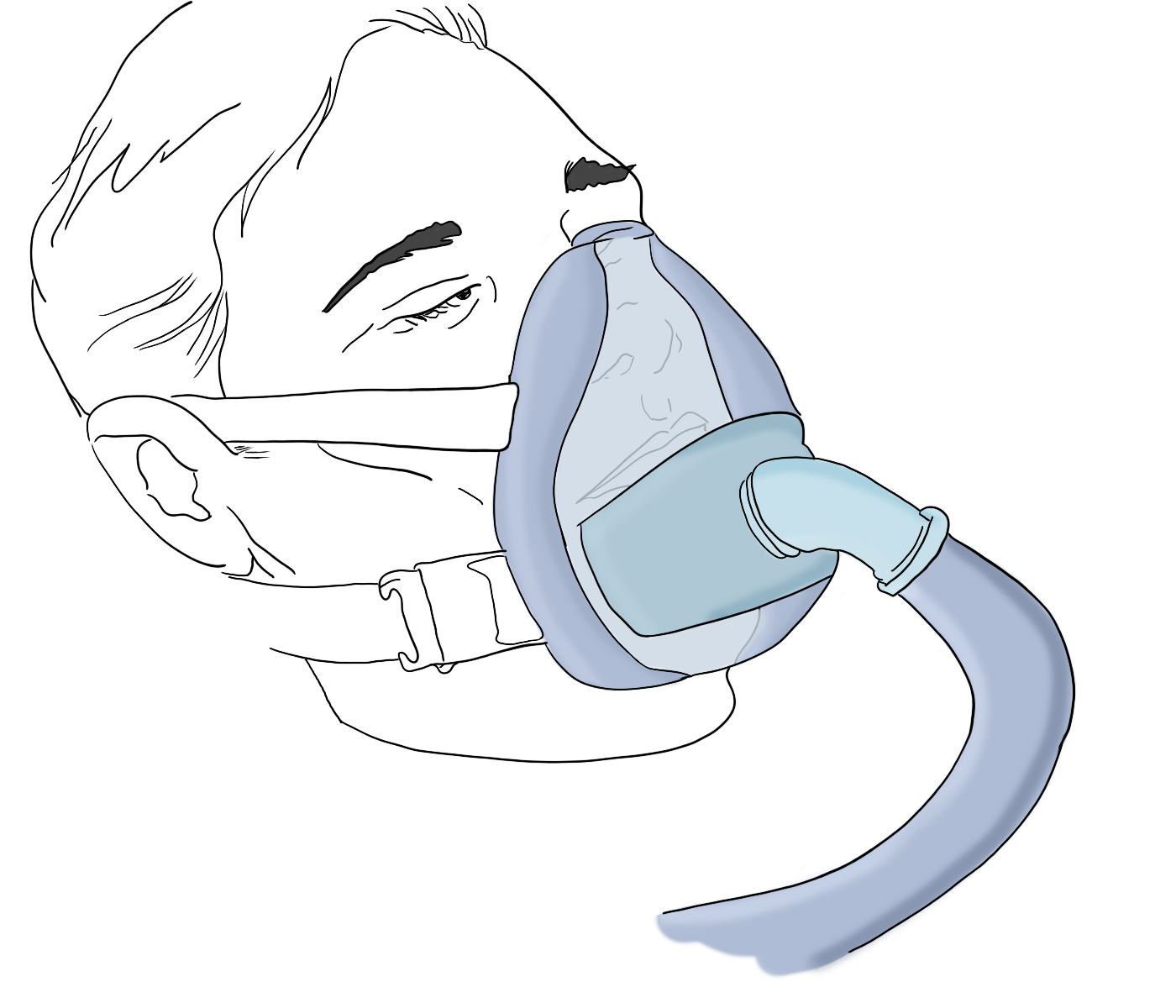 Patients with non-invasive ventilation