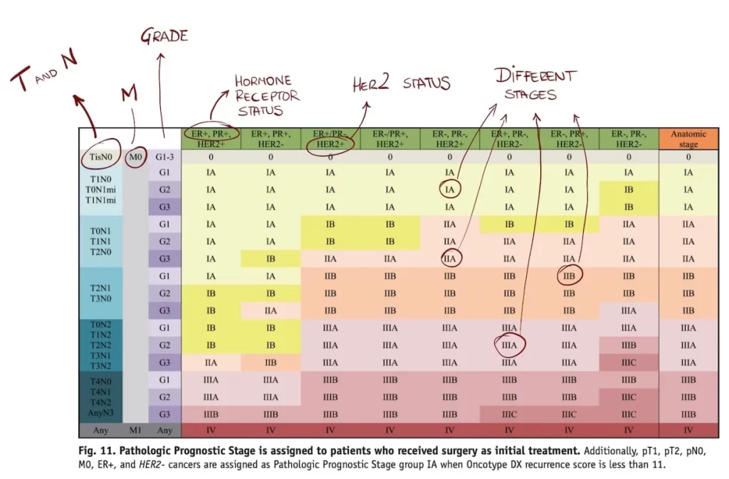 Breast cancer stages table