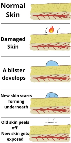 Diagram with formation of blisters