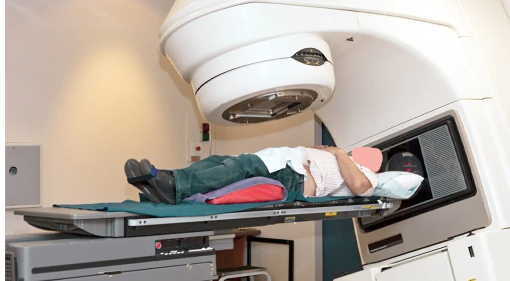 radiation therapy for prostate cancer