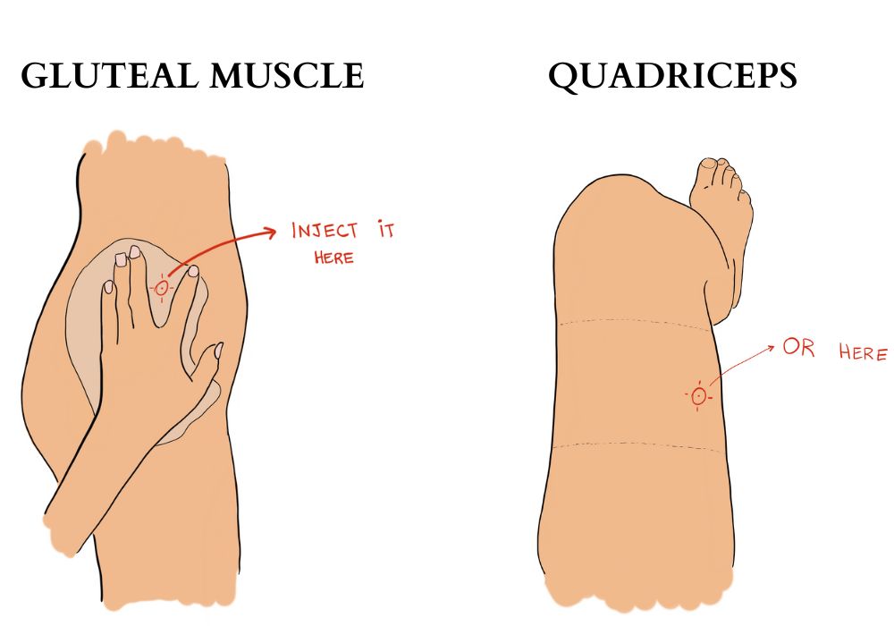 gluteus and quadriceps as sites for IM injection